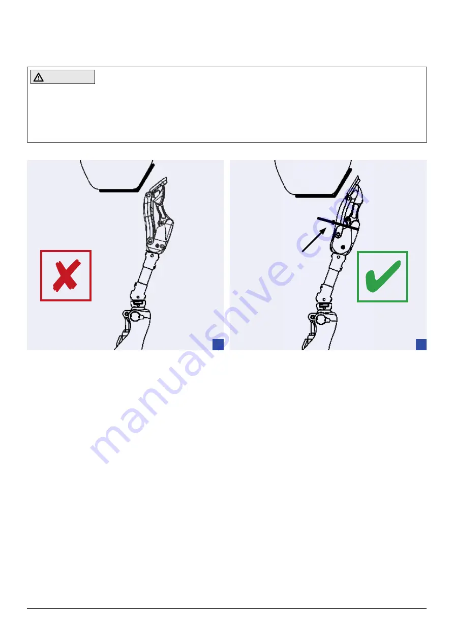 Otto Bock 7E10 Helix 3D Instructions For Use Manual Download Page 256