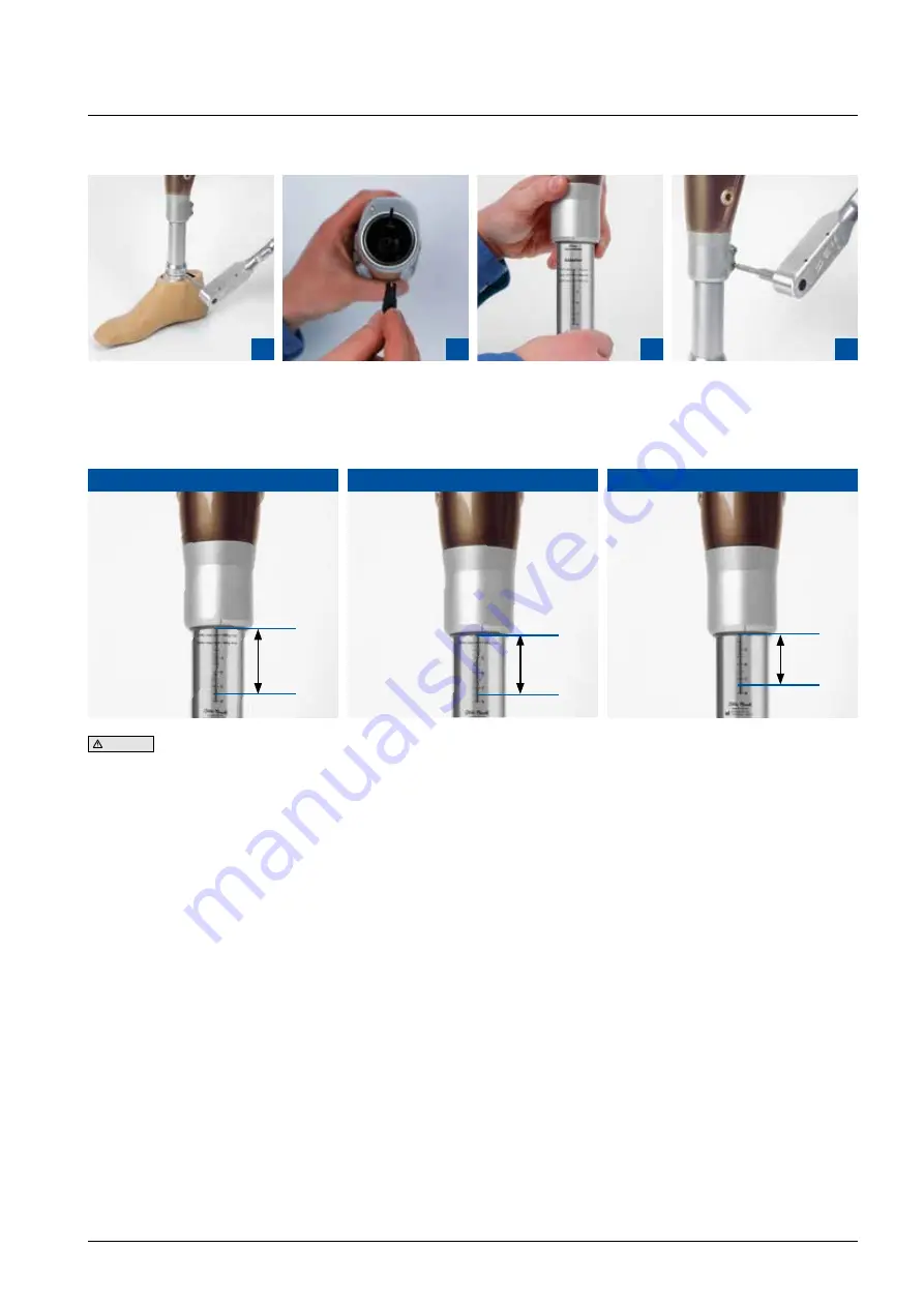 Otto Bock C-Leg Prosthetic System Скачать руководство пользователя страница 10