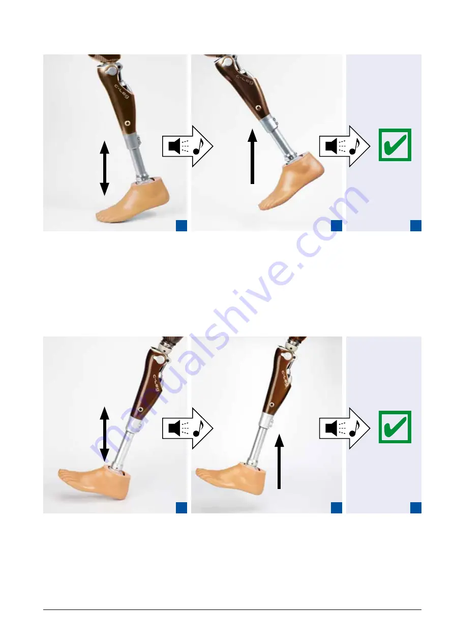 Otto Bock C-Leg Prosthetic System Скачать руководство пользователя страница 18