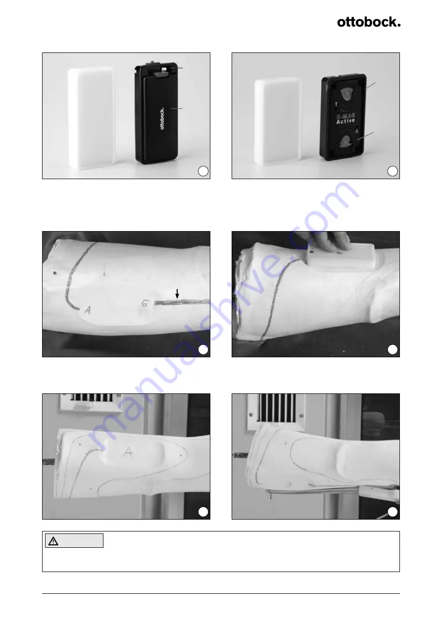 Otto Bock E-MAG Active 17B202N Mounting And Service Instructions Download Page 49