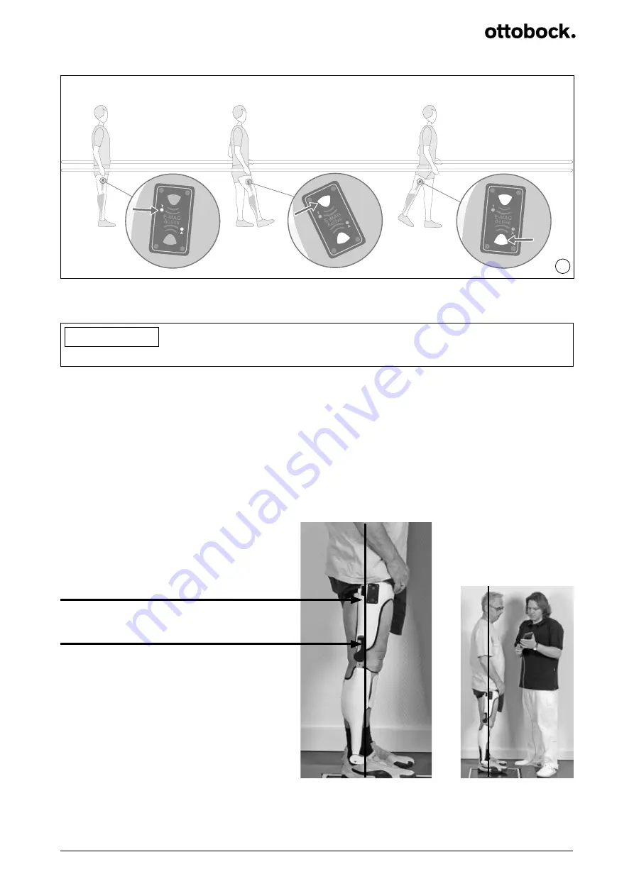 Otto Bock E-MAG Active 17B202N Mounting And Service Instructions Download Page 62