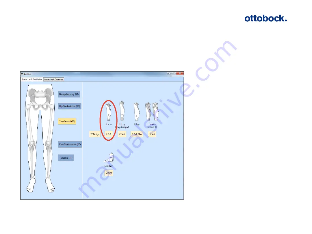 Otto Bock Kenevo 3C60 Introduction Manual Download Page 86