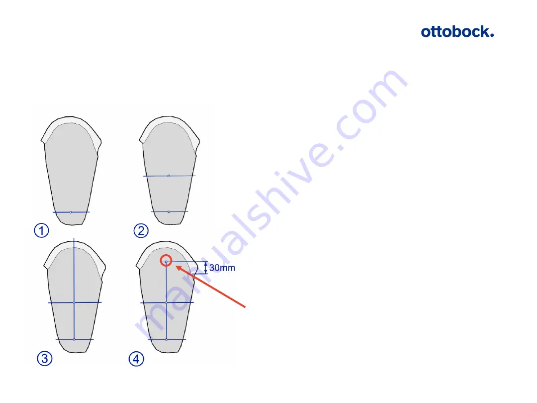 Otto Bock Kenevo 3C60 Introduction Manual Download Page 105