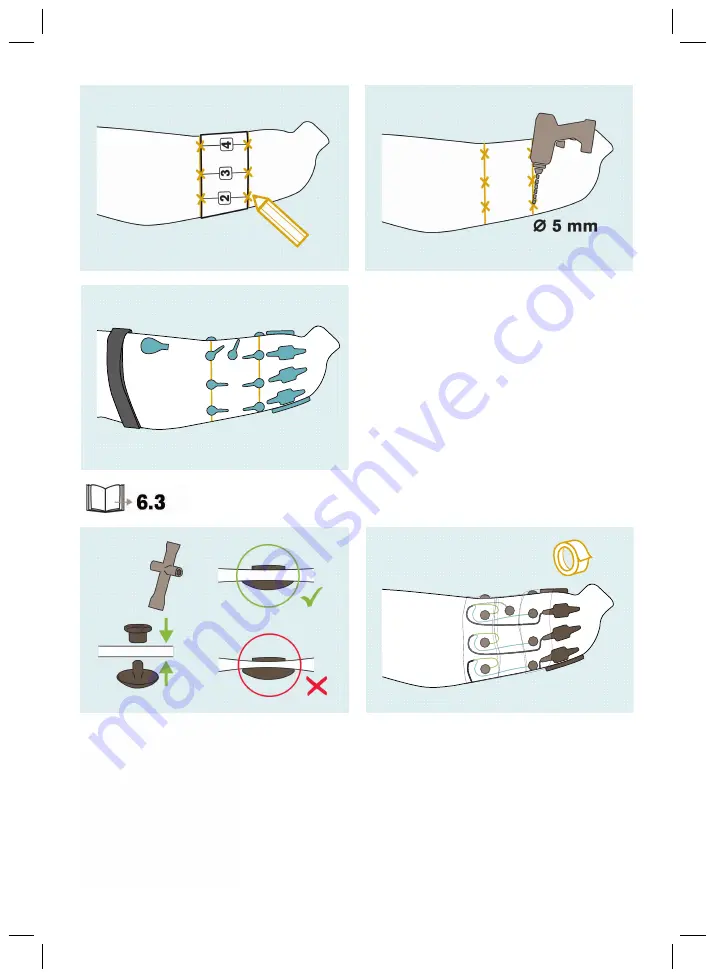 Otto Bock Myo Plus TR Instructions For Use Manual Download Page 4