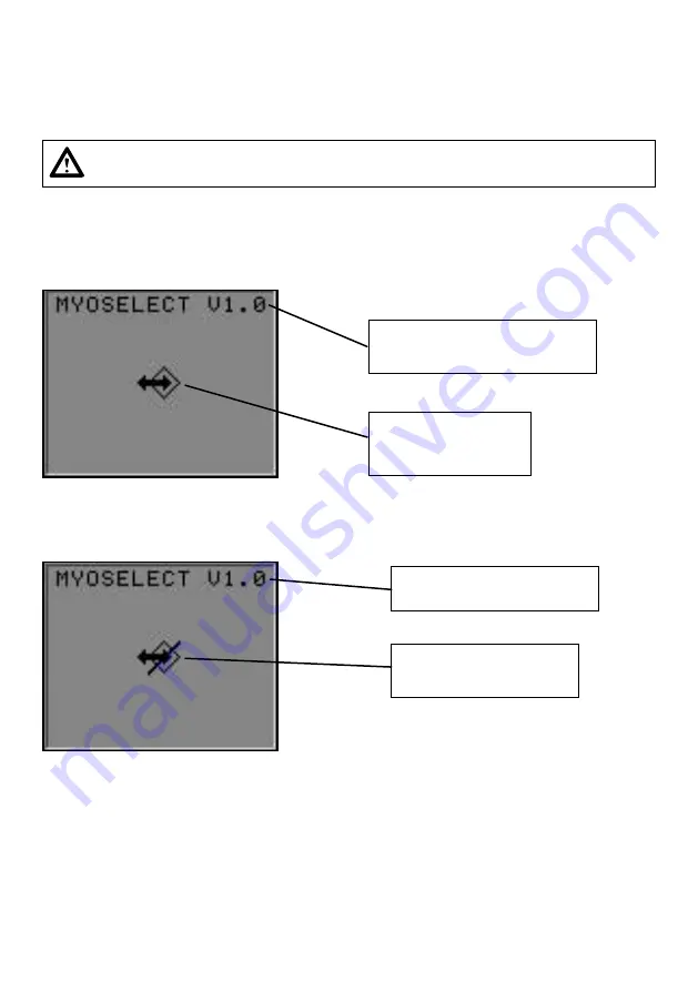 Otto Bock MyoSelect 757T13 Скачать руководство пользователя страница 45