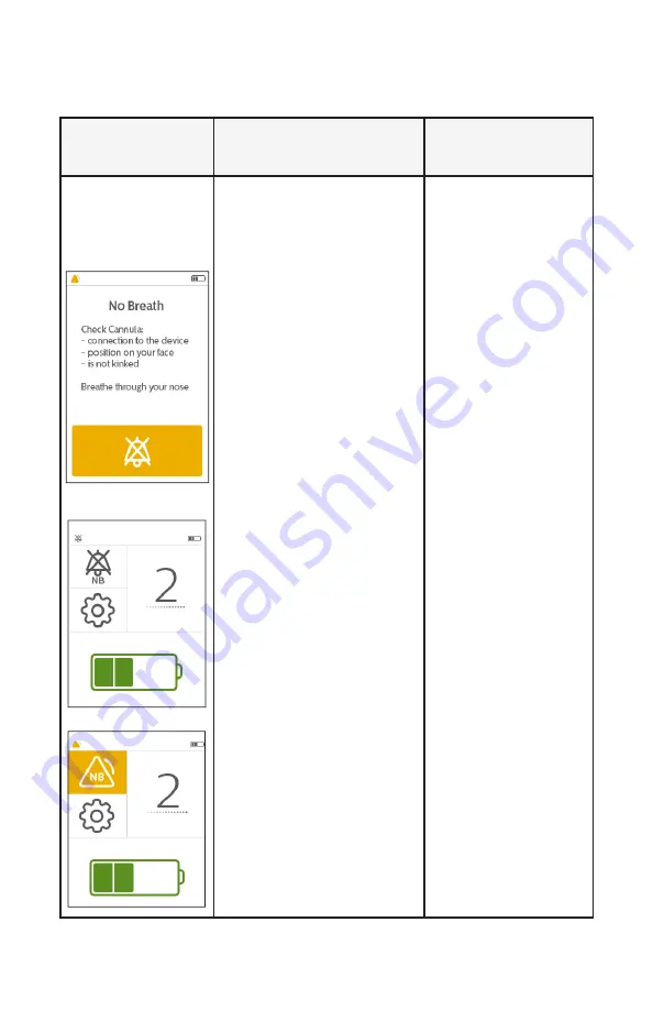 PHILIPS Respironics SimplyGo Mini Manual Download Page 28