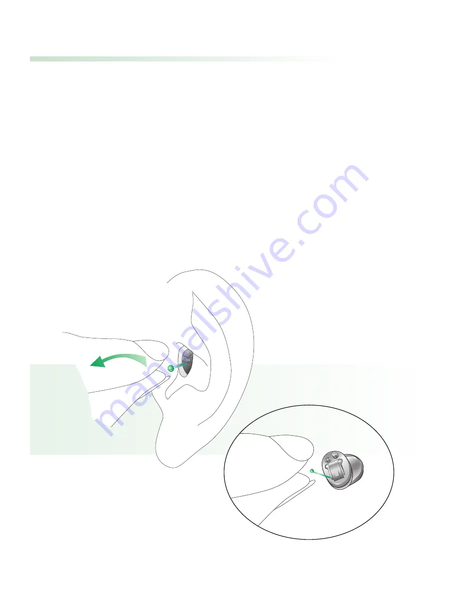 Phonak Una CIC/MC User Manual Download Page 14