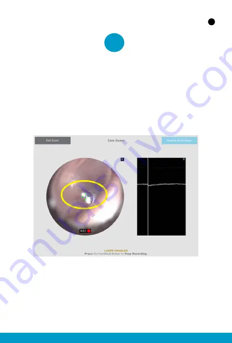 PhotoniCare TOMi Scope Quick Start Pocket Manual Download Page 8