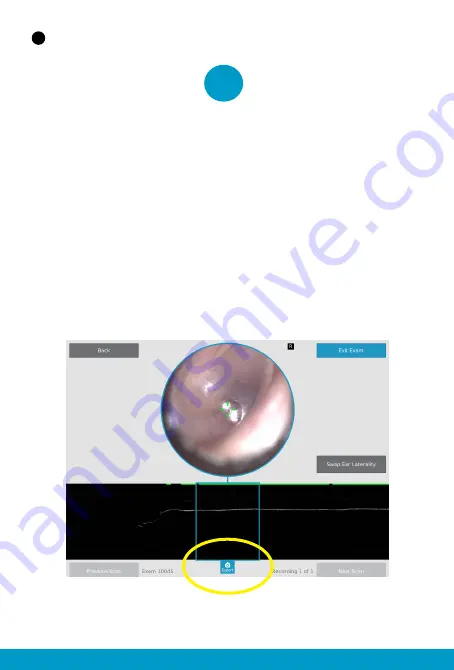 PhotoniCare TOMi Scope Скачать руководство пользователя страница 11