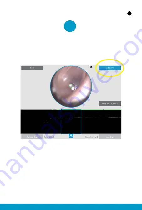 PhotoniCare TOMi Scope Quick Start Pocket Manual Download Page 12