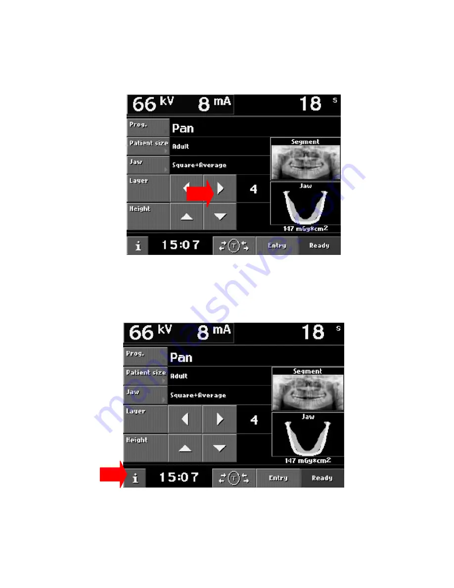 Planmeca Proline XC Panoramic Calibration Manual Download Page 33