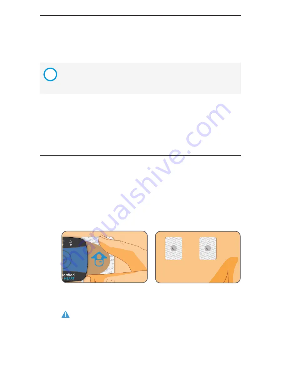 Preventice Technologies BodyGuardian HEART Instructions For Use Manual Download Page 28