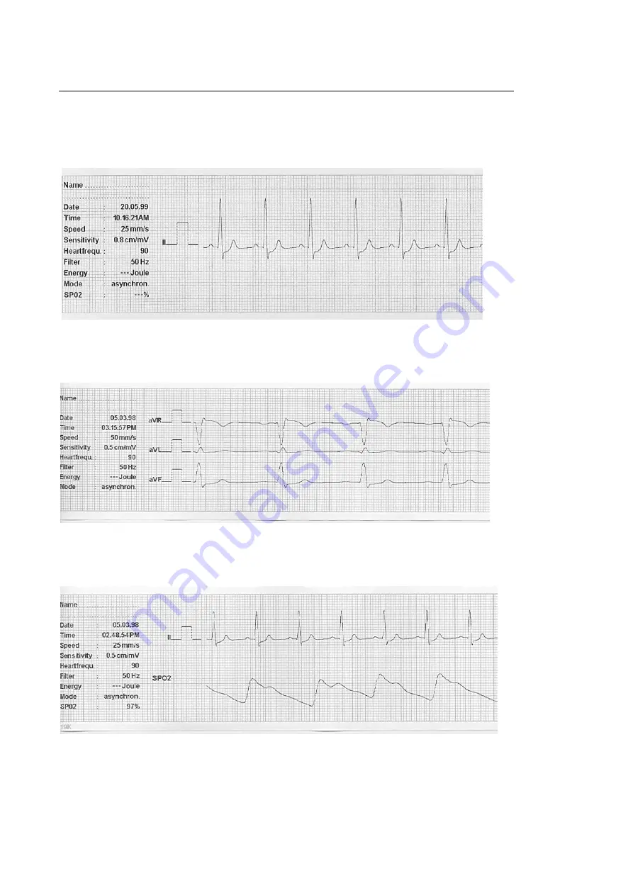 Primedic Defi-Monitor DM 1 Instructions For Use Manual Download Page 54