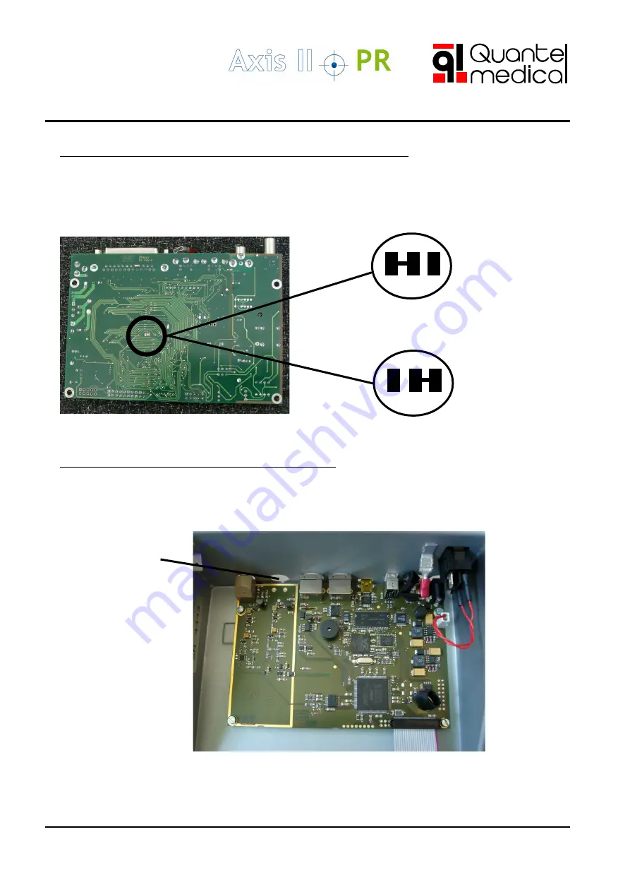 Quantel Medical Axis II PR Service Manual Download Page 34