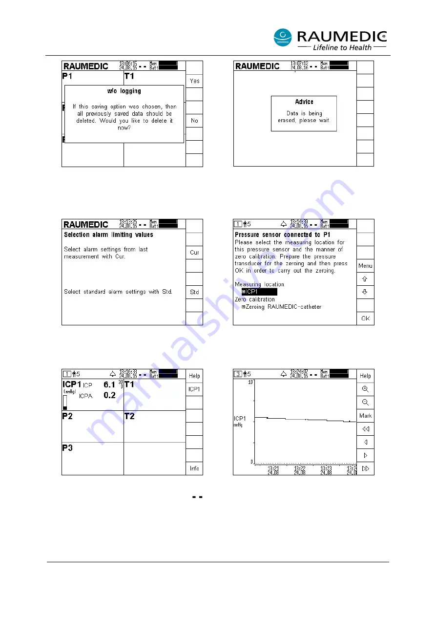 RAUMEDIC MPR2 logO Instructions For Use Manual Download Page 34