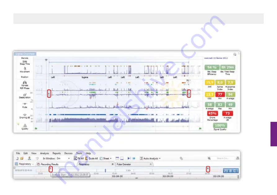 ResMed Nox A1 Скачать руководство пользователя страница 44