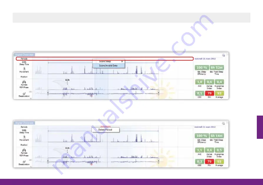 ResMed Nox A1 How To Use Manual Download Page 45