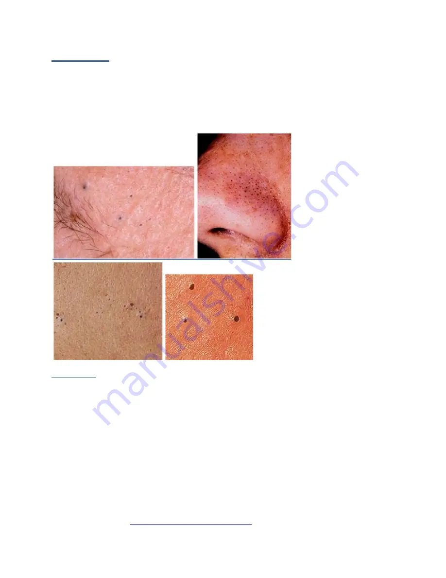 Rn faces Skin classic Manual Download Page 16