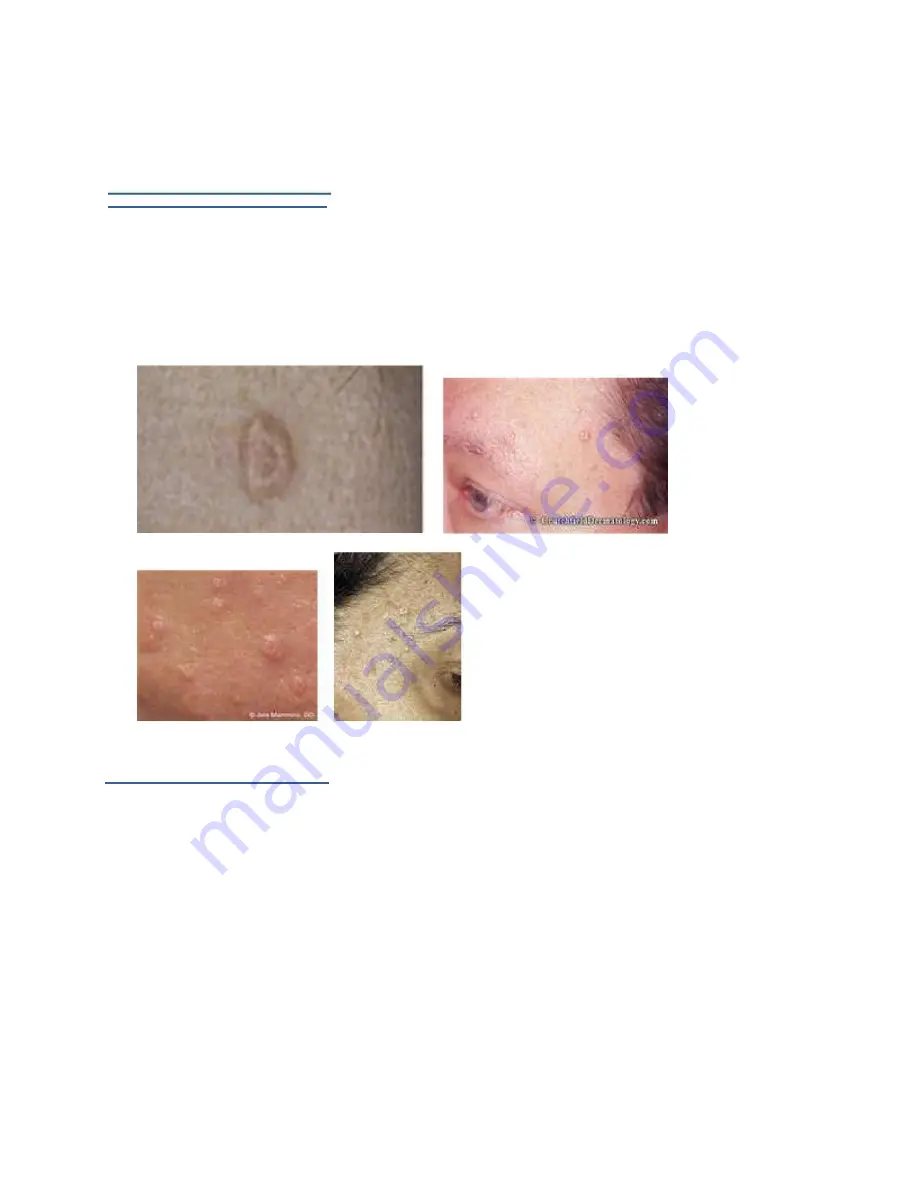 Rn faces Skin classic Manual Download Page 18