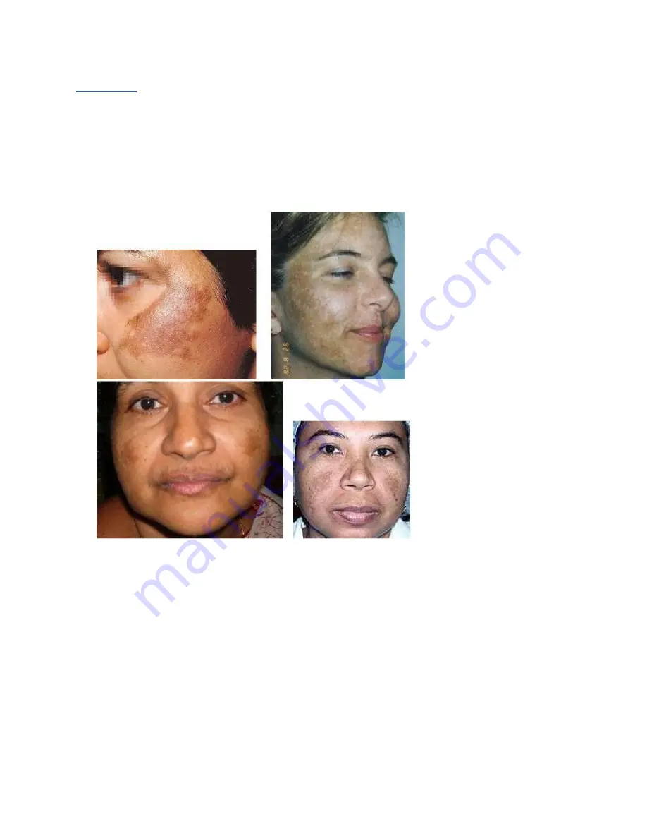 Rn faces Skin classic Manual Download Page 35