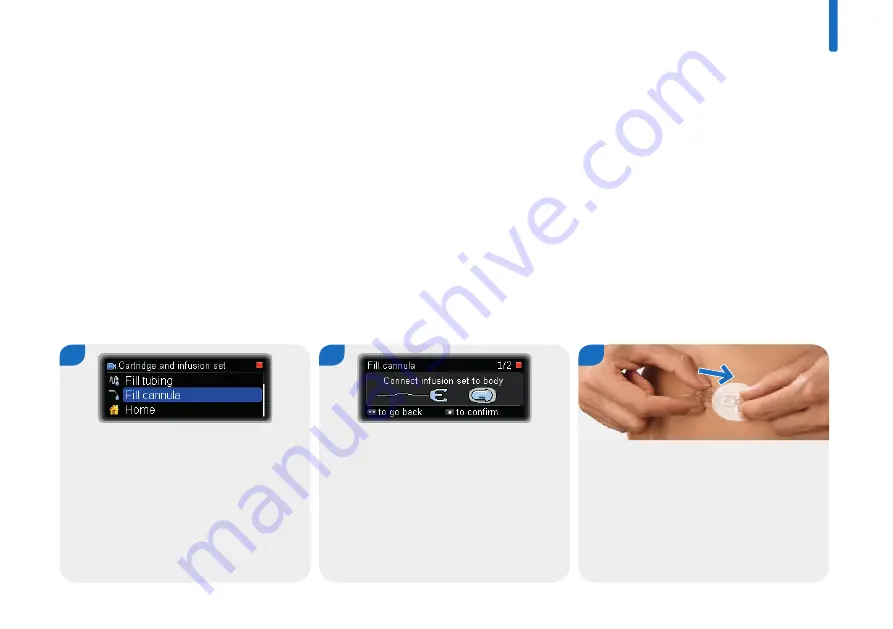 Roche Accu-Check Insight Скачать руководство пользователя страница 43