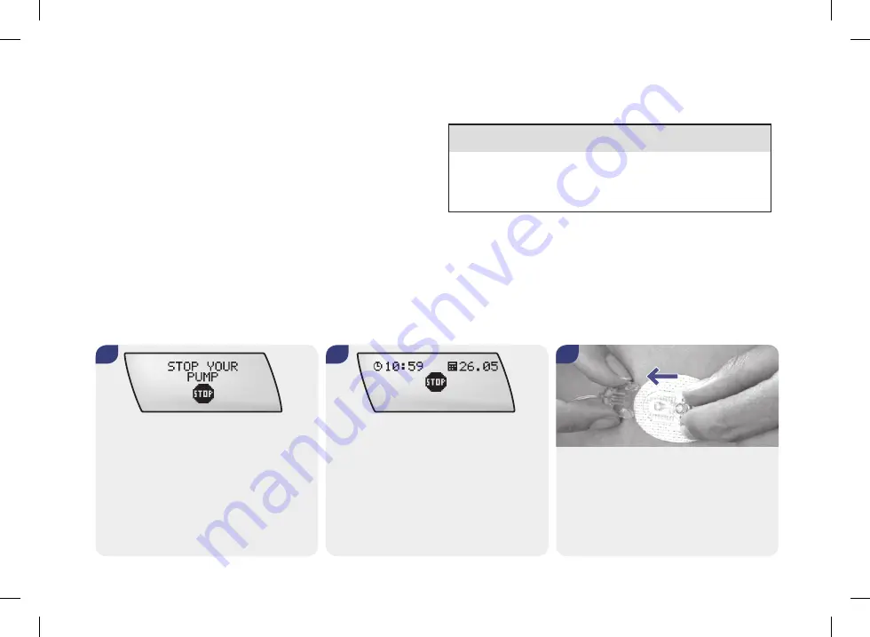 Roche ACCU-CHEK Spirit Combo User Manual Download Page 48