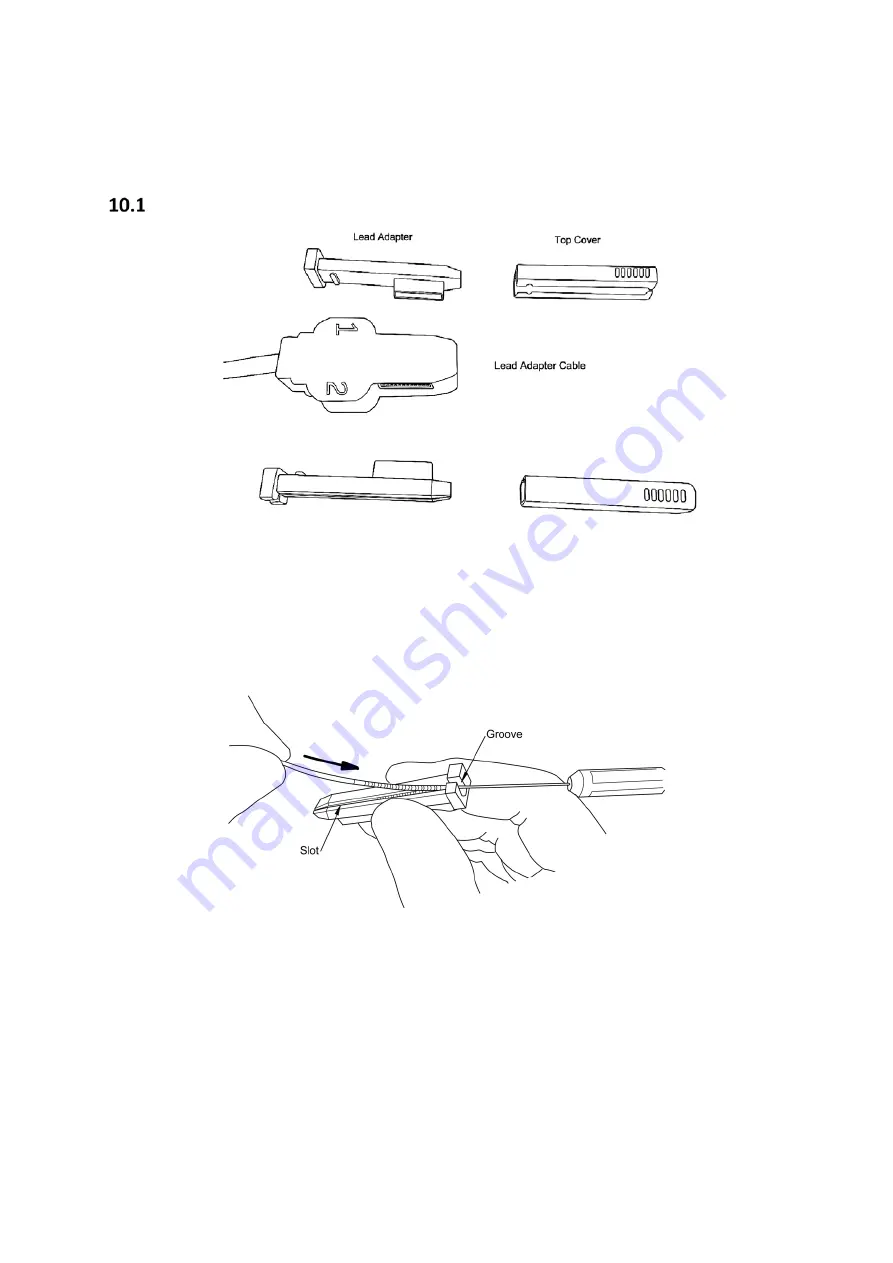 SALUDA MEDICAL Evoke 12C Surgical Manual Download Page 24