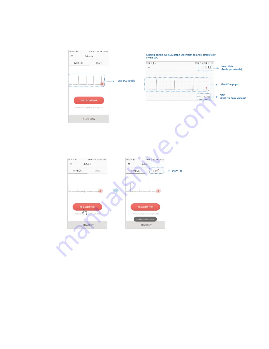 Samsung SDS S-PATCH3-Cardio User Manual Download Page 14