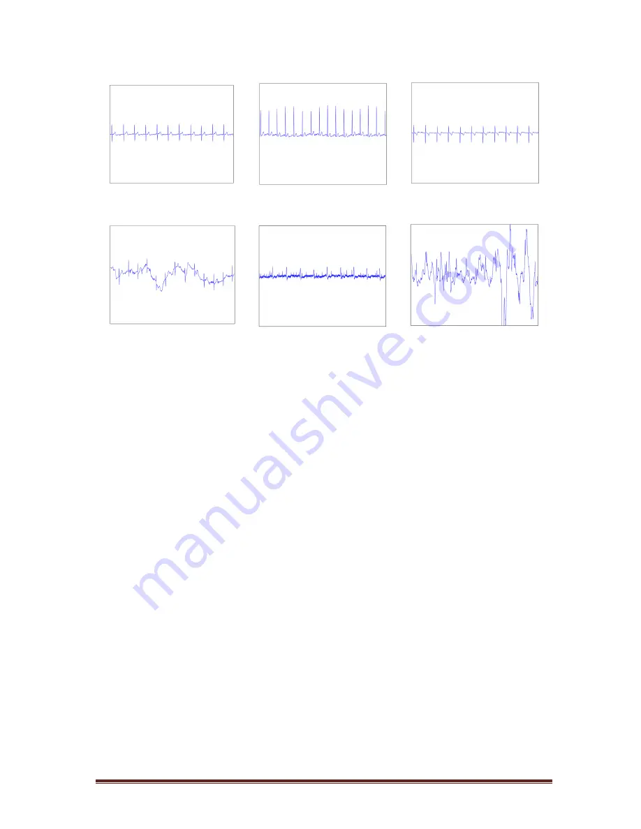 SAVING Savvy ECG User Manual Download Page 22