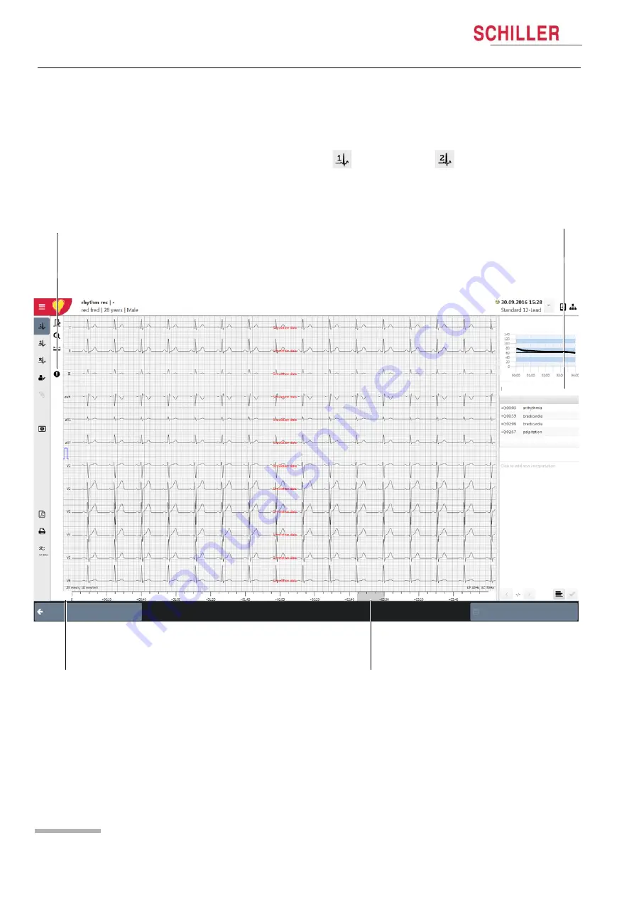 Schiller CARDIOVIT CS-104 Скачать руководство пользователя страница 96