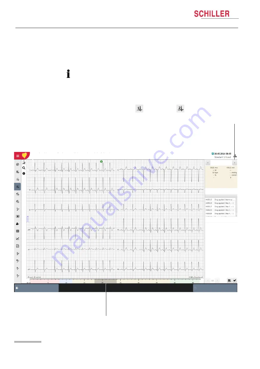 Schiller CARDIOVIT CS-104 Скачать руководство пользователя страница 106