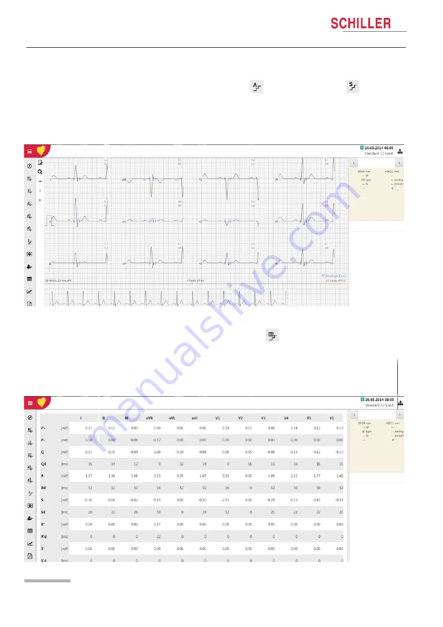 Schiller CARDIOVIT CS-104 Скачать руководство пользователя страница 108