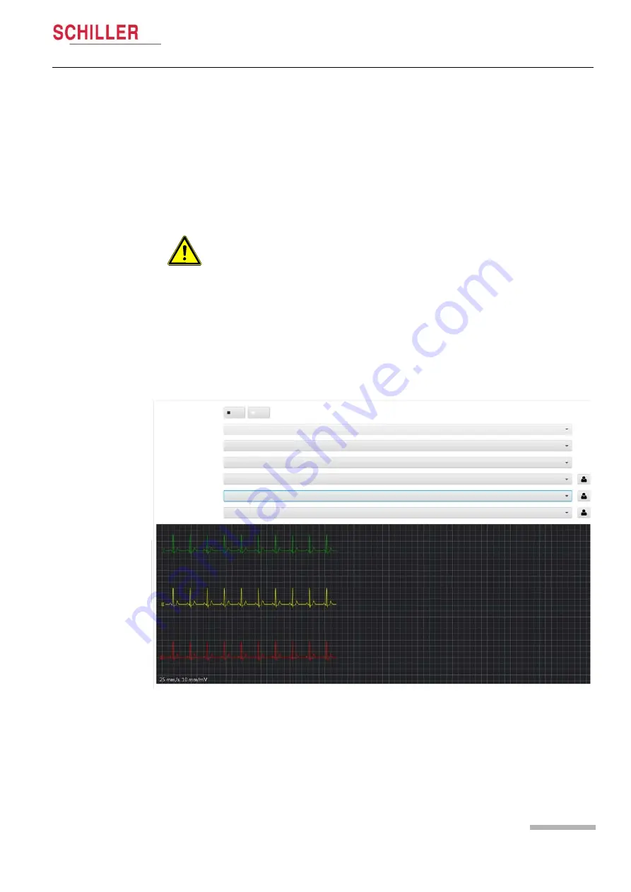 Schiller CARDIOVIT CS-104 User Manual Download Page 121