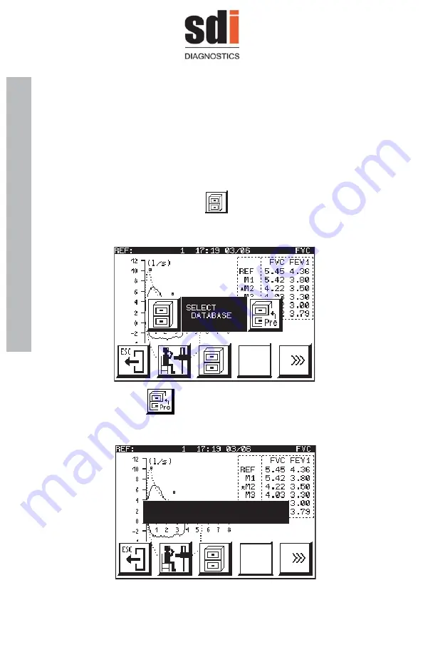 SDI Astra 300 User Manual Download Page 48