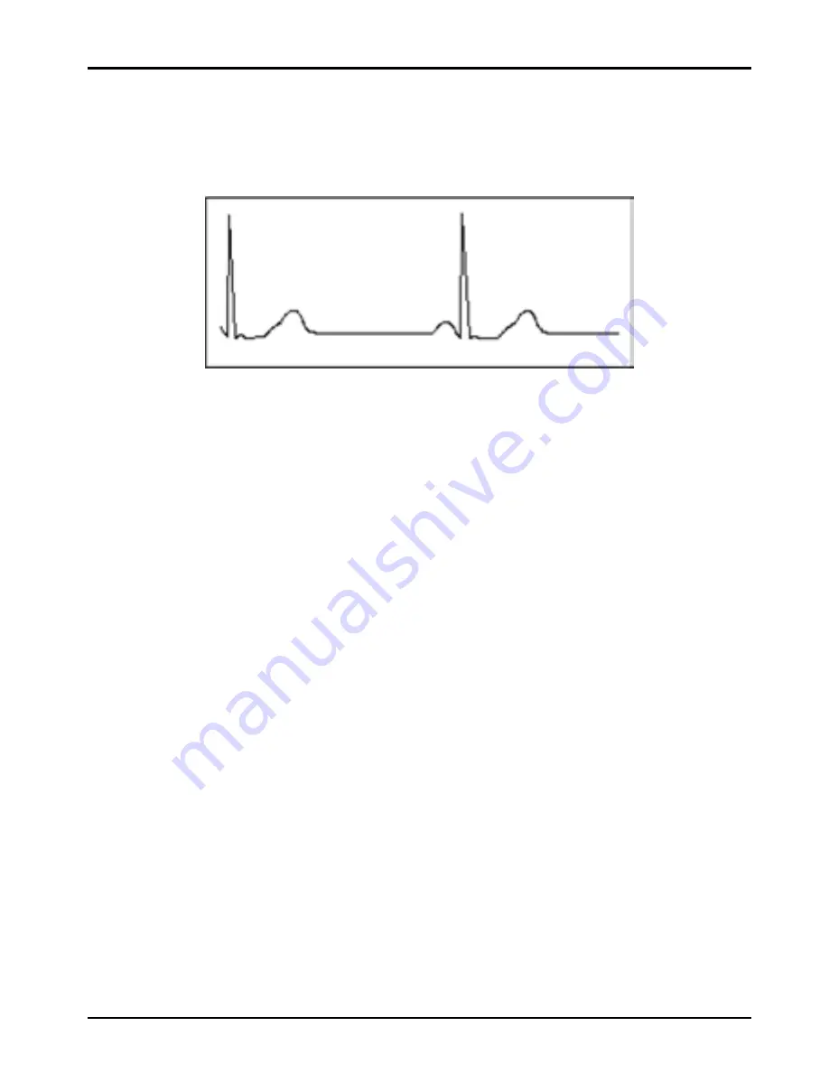 Shenzhen Creative Industry Co. Easy ECG Скачать руководство пользователя страница 53