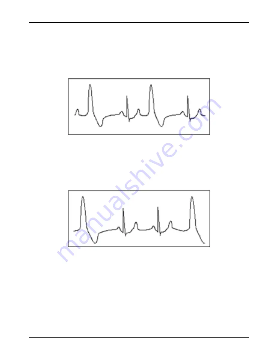 Shenzhen Creative Industry Co. Easy ECG Скачать руководство пользователя страница 55