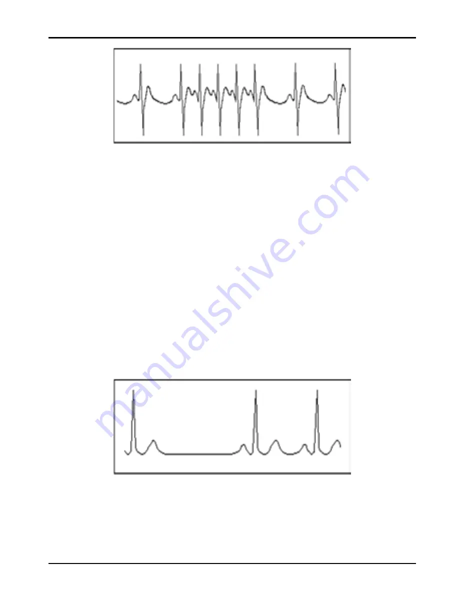 Shenzhen Creative Industry Co. Easy ECG Скачать руководство пользователя страница 57