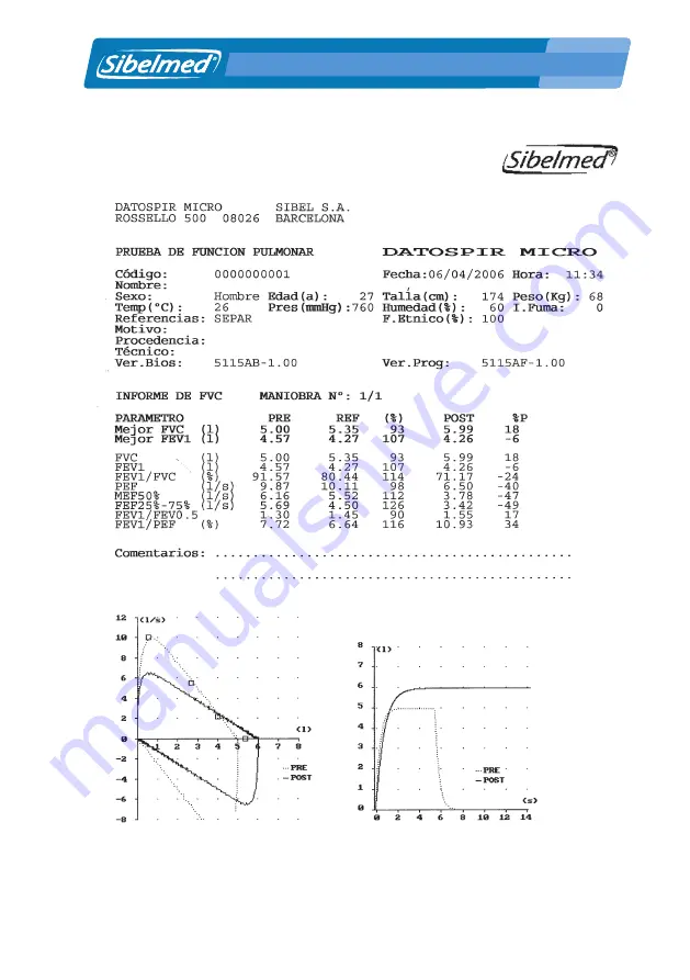 Sibelmed DATOSPIR MICRO A User Manual Download Page 67