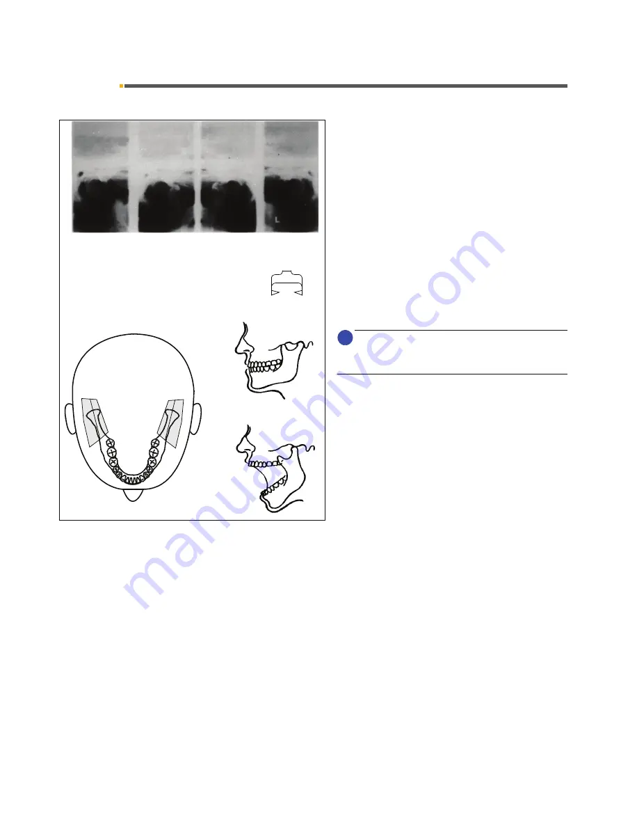 Sirona Orthophos 3 Скачать руководство пользователя страница 95