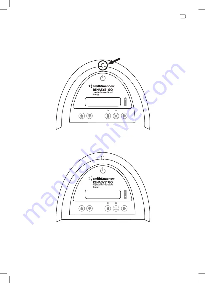 Smith & Nephew RENASYS GO 66801496 Скачать руководство пользователя страница 59