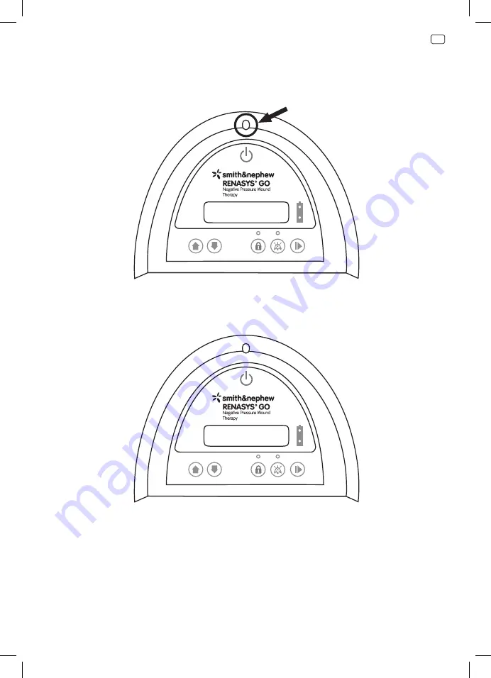 Smith & Nephew RENASYS GO 66801496 Скачать руководство пользователя страница 143