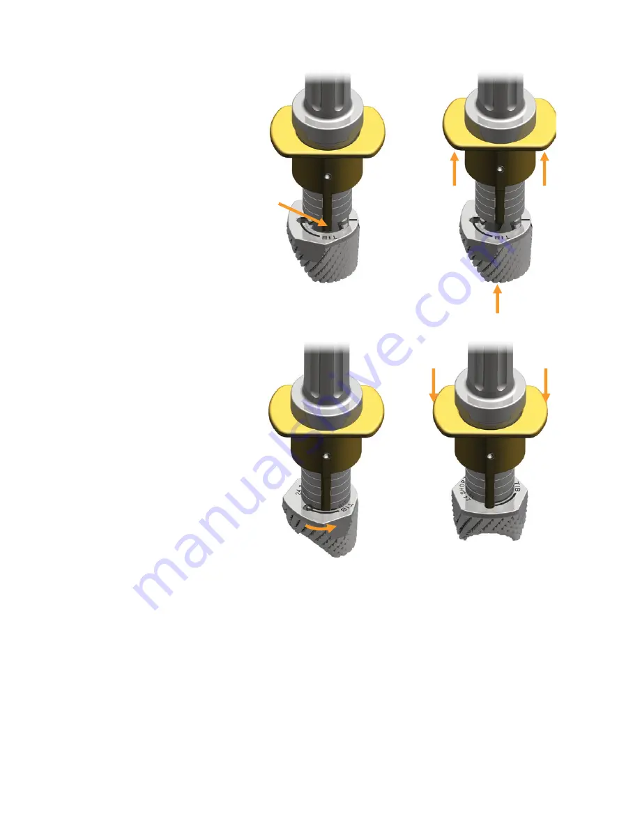 smith&nephew LEGION Cones Surgical Technique Download Page 6