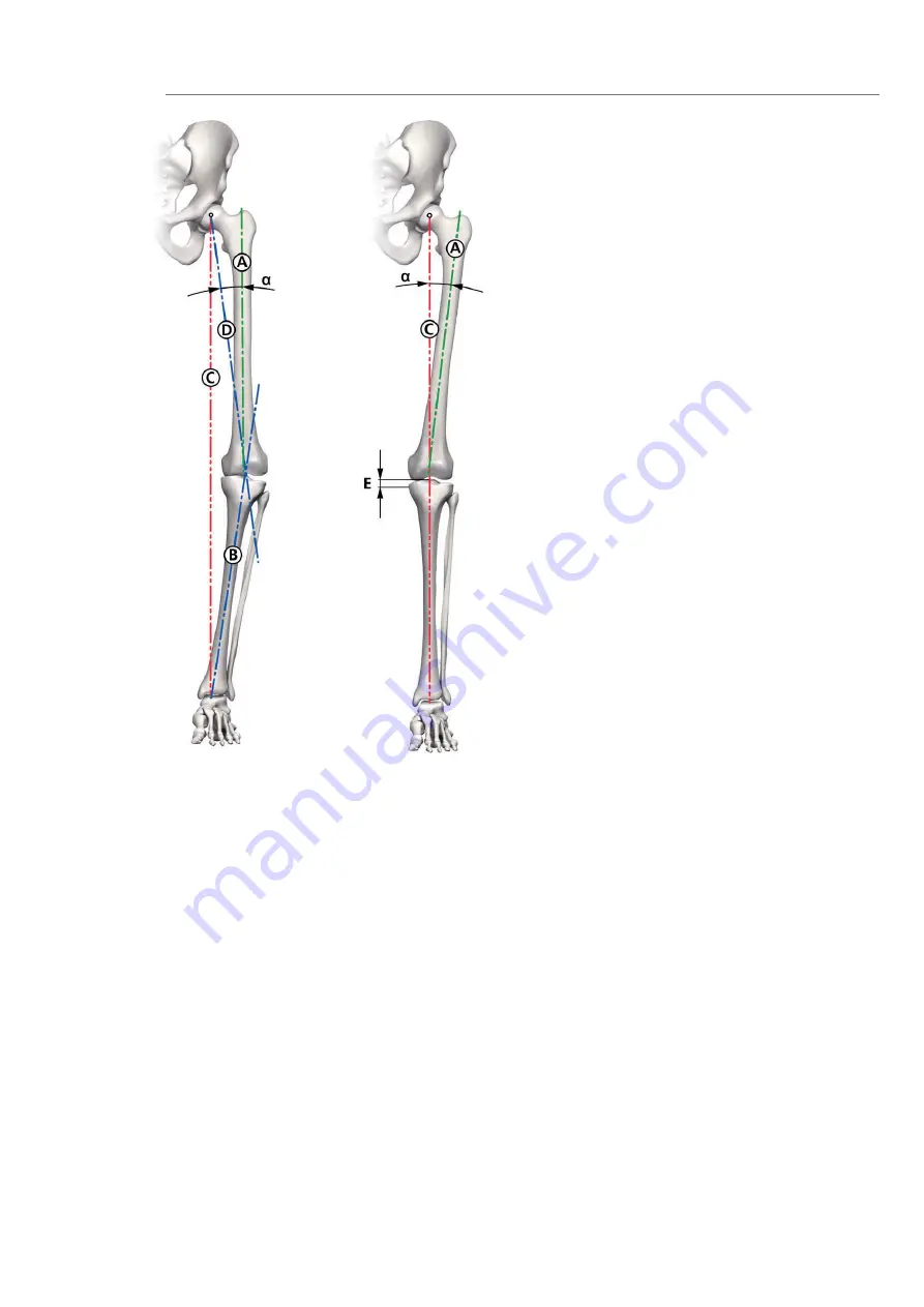 smith&nephew RT-PLUS Surgical Technique Download Page 13