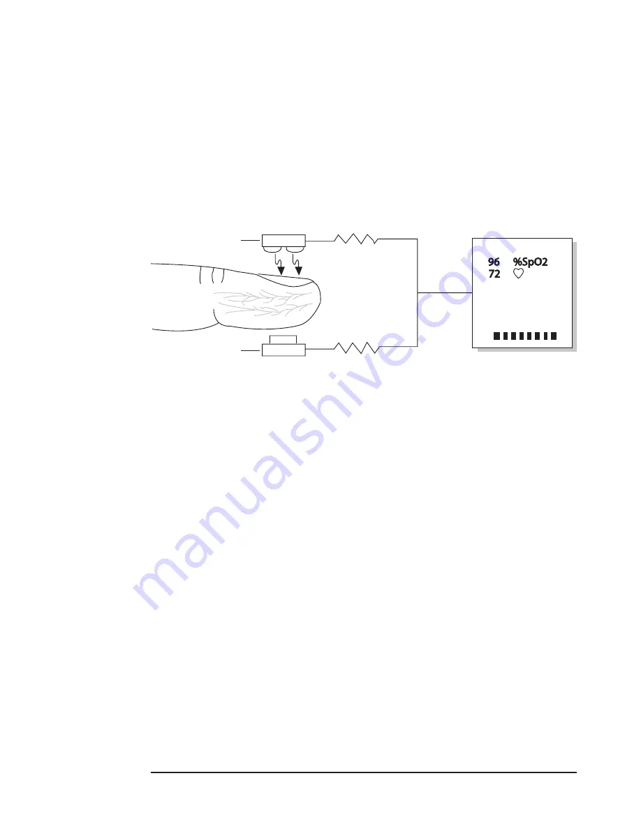 Smiths Medical 1884SS Operation Manual Download Page 14