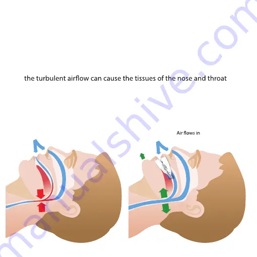 Snore Reliever Company VitalSleep Instruction Manual Download Page 3