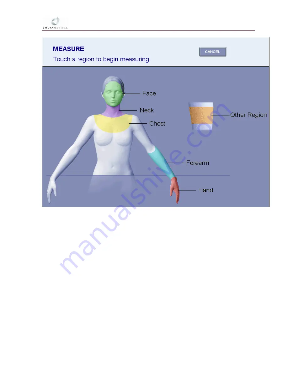 Solta Medical Fraxel 1550 Operator'S Manual Download Page 34