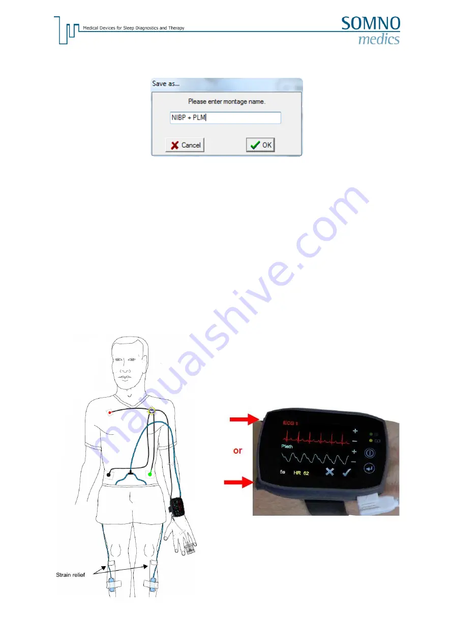 SOMNOmedics NIBP PLM Instruction Manual Download Page 6