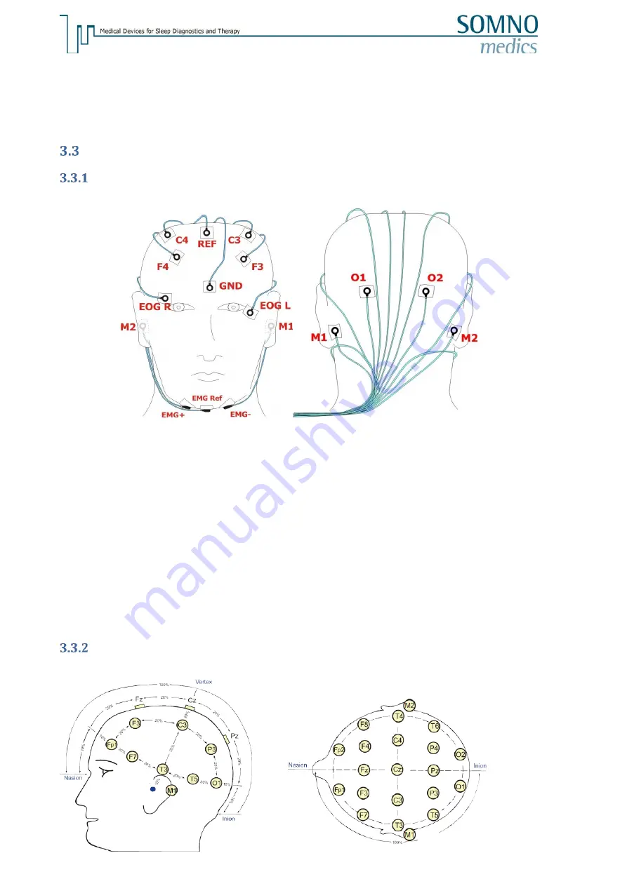 SOMNOmedics SOMNO HD NGD050 Instruction Manual Download Page 20