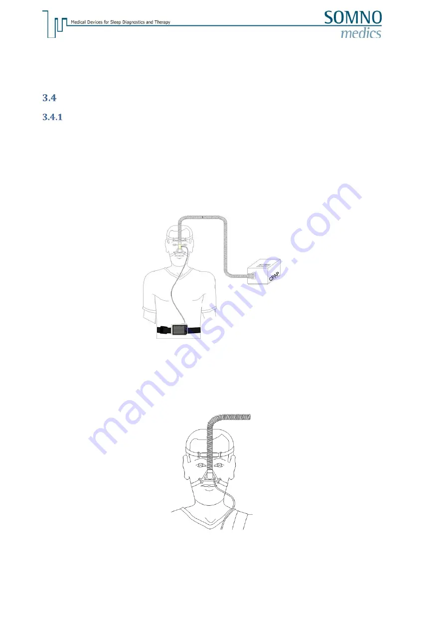 SOMNOmedics SOMNO HD NGD050 Instruction Manual Download Page 22