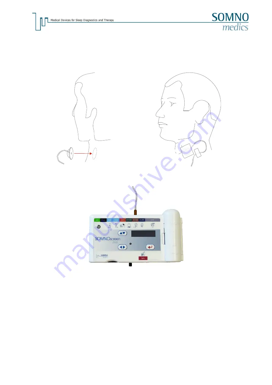 SOMNOmedics SOMNOscreen plus Instruction Manual Download Page 31